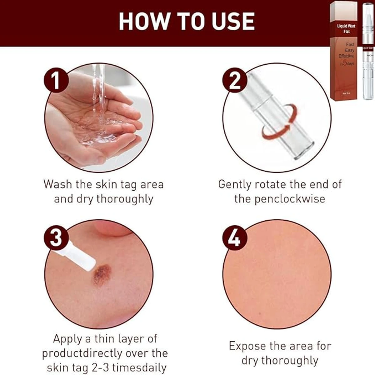 Skin Tags & Moles Remover,Wipe Off Tags